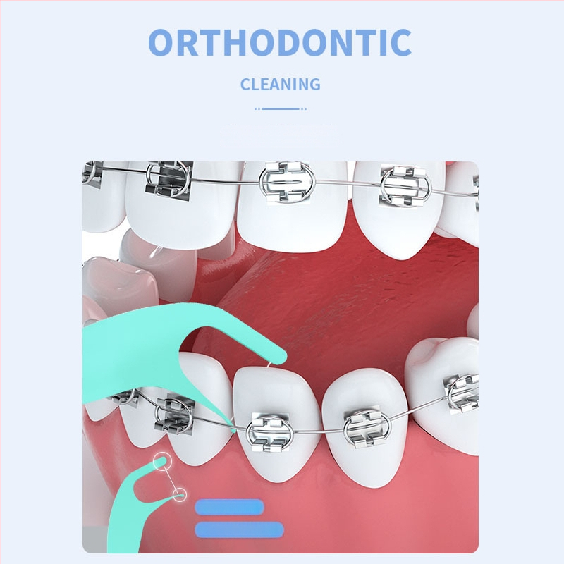 Bețe de ață ortodontică pentru aparat dentar, din plastic, 50–80 buc./ambalaj, ambalaj în vrac, origine Shenzhen
