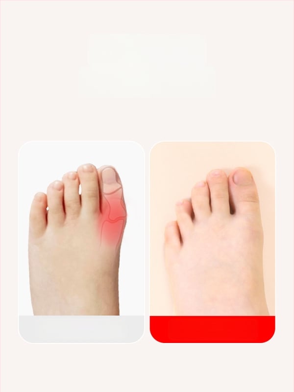 Detský korektor valgusu palca s elastickou páskou – bavlnená textúra, 30 kusov, pre deti, na behanie a basketbal