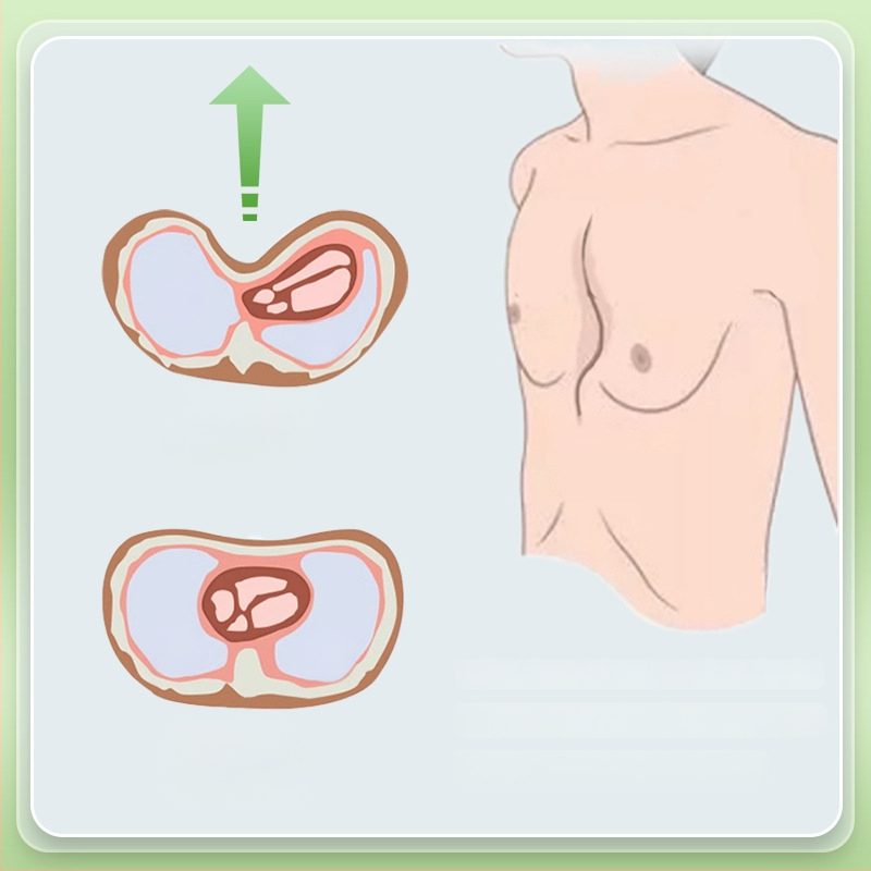 Коректор за фуниеобразен гръден кош с вакуумна чашка — силиконово тяло, модел YKS-4031, марка Medium
