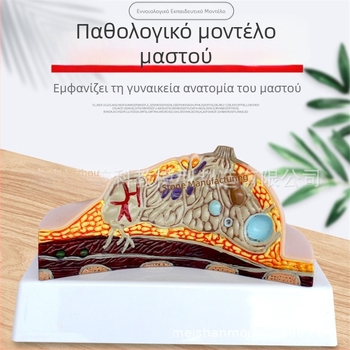 Μοντέλο παθολογίας μαστού για ιατρική εκπαίδευση