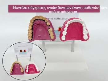 Μοντέλο Οδοντικής Ανατομίας με Δομικό Σχήμα για Εκπαίδευση και Οδοντική Φροντίδα