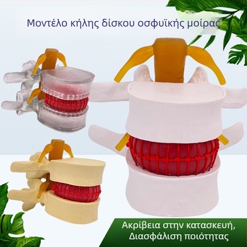 Μοντέλο οσφυϊκής σπονδυλικής στήλης για ιατρική εκπαίδευση – επίδειξη συμπίεσης δίσκου οσφυϊκής περιοχής και παθολογία των οστών της σπονδυλικής στήλης.