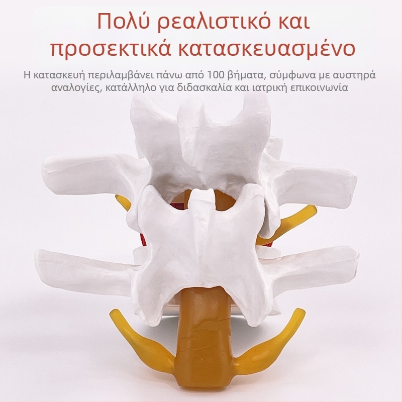 Μοντέλο οσφυϊκής σπονδυλικής στήλης για ιατρική εκπαίδευση – επίδειξη συμπίεσης δίσκου οσφυϊκής περιοχής και παθολογία των οστών της σπονδυλικής στήλης.
