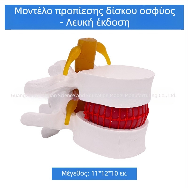Μοντέλο οσφυϊκής σπονδυλικής στήλης για ιατρική εκπαίδευση – επίδειξη συμπίεσης δίσκου οσφυϊκής περιοχής και παθολογία των οστών της σπονδυλικής στήλης.