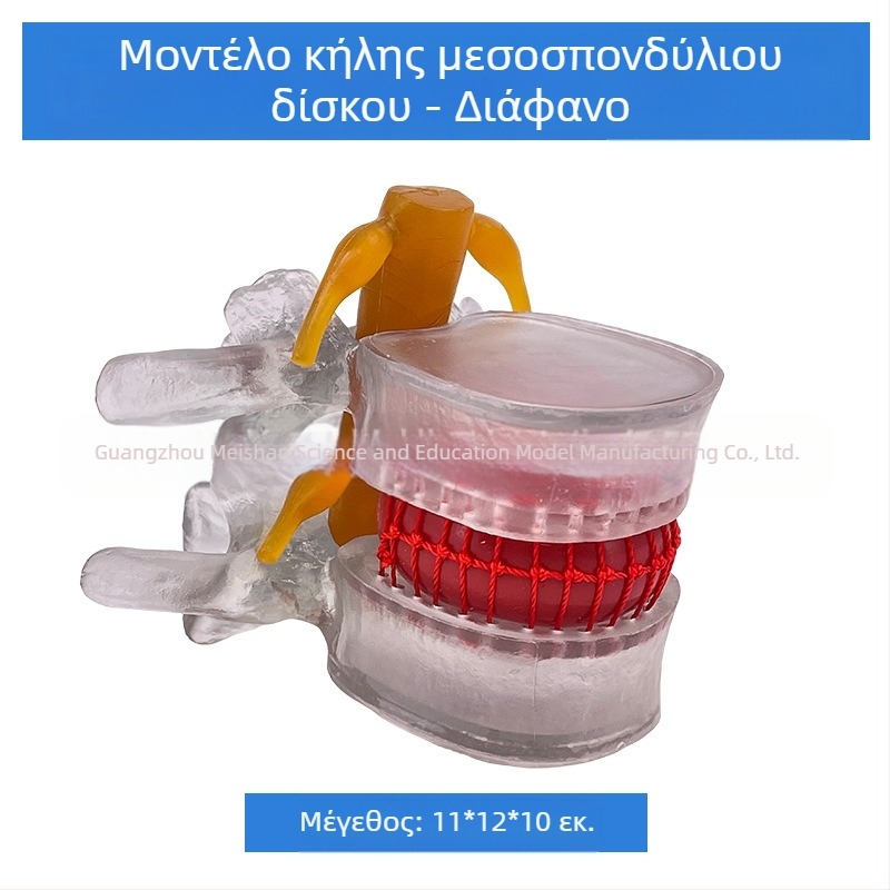Μοντέλο οσφυϊκής σπονδυλικής στήλης για ιατρική εκπαίδευση – επίδειξη συμπίεσης δίσκου οσφυϊκής περιοχής και παθολογία των οστών της σπονδυλικής στήλης.