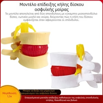 Μοντέλο μεσοσπονδύλιου δίσκου, PVC εκπαιδευτικό ανατομικό μοντέλο για παθολογία της οσφυϊκής μοίρας, από Zhenghe River