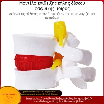 Μοντέλο μεσοσπονδύλιου δίσκου, PVC εκπαιδευτικό ανατομικό μοντέλο για παθολογία της οσφυϊκής μοίρας, από Zhenghe River