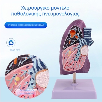 Blue Butterfly πλαστικό μοντέλο εσωτερικών οργάνων: τραχεία και πνεύμονες - ανατομία με παθολογία και διατομή καπνιστικού πνεύμονα.