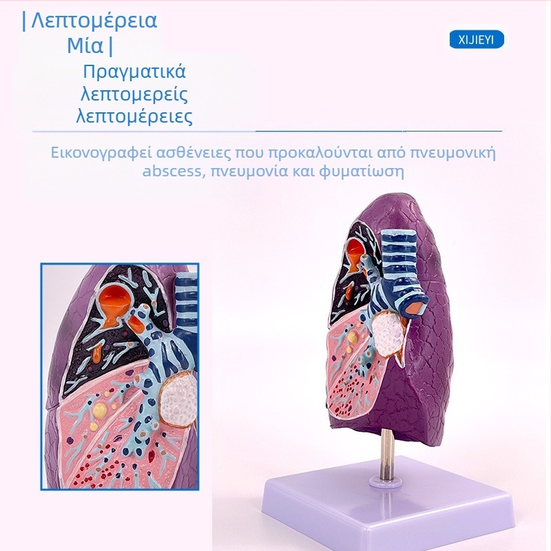 Blue Butterfly πλαστικό μοντέλο εσωτερικών οργάνων: τραχεία και πνεύμονες - ανατομία με παθολογία και διατομή καπνιστικού πνεύμονα.