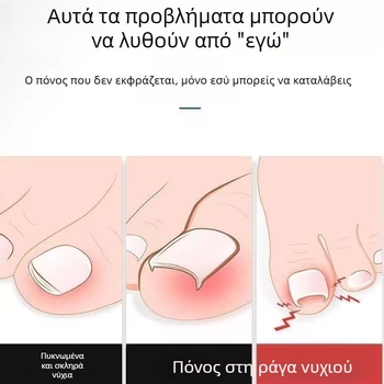 Σετ περιποίησης νυχιών από ανοξείδοτο ατσάλι: τσιμπίδες αυλακώσεων νυχιών, νυχιών σε κεκλιμένη κοπή και πολλαπλές λαβίδες