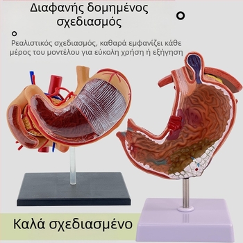 Μοντέλο ανατομίας ανθρώπινου στομάχου — κορωνική τομή, παθολογικό μοντέλο στομάχου με διάτρηση, εκπαίδευση γαστροεντερολογίας