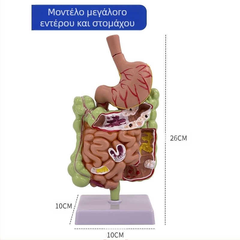 Μοντέλο ανατομίας ανθρώπινου στομάχου — κορωνική τομή, παθολογικό μοντέλο στομάχου με διάτρηση, εκπαίδευση γαστροεντερολογίας
