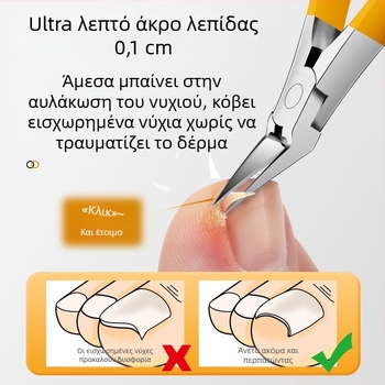 Mingxiang κλιπέρ νυχιών για ανάπτυξη – πλαστικό + ανοξείδωτο ατσάλι, φορητό για οικιακή χρήση, λαβίδες αυλακώσεων νυχιών, πολυλειτουργικά τσιμπιδάκια