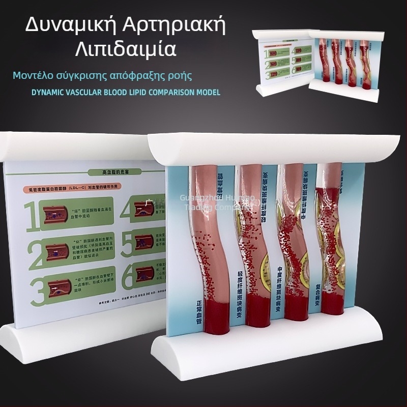Δυμαμικό μοντέλο αγγειακού συστήματος από πλαστικό για επίδειξη απόφραξης υψηλής πυκνότητας και θρόμβου πλάκας – διδακτικό μοντέλο