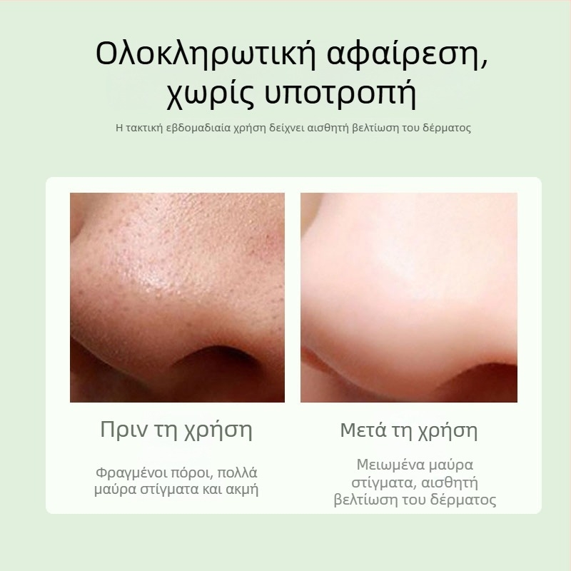 Συσκευή οπτικού καθαρισμού προσώπου για μαύρα στίγματα, με οθόνη HD, βαθύς καθαρισμός πόρων μέσω αναρρόφησης