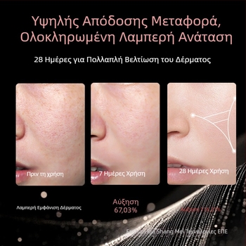 Συσκευή ανάπλασης προσώπου με μείωση ρυτίδων, υπέρυθρη ακτινοβολία, IPX3 αδιάβροχη, τροφοδοτούμενη από το δίκτυο για οικιακή χρήση