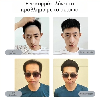 Ανδρική περούκα με γραμμή μαλλιών - φυσικά ανθρώπινα μαλλιά, πλήρης χειροποίητη ύφανση, Μ-σχήμα προεξοχής, τύπος φράντζ: ευθύγραμμες ή κεκλιμένες, προσθέτει όγκο στη γραμμή της μετωπής