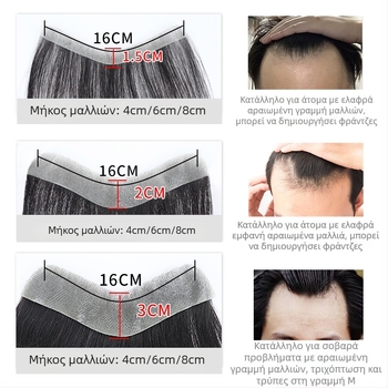 Ανδρική περούκα με γραμμή μαλλιών - φυσικά ανθρώπινα μαλλιά, πλήρης χειροποίητη ύφανση, Μ-σχήμα προεξοχής, τύπος φράντζ: ευθύγραμμες ή κεκλιμένες, προσθέτει όγκο στη γραμμή της μετωπής