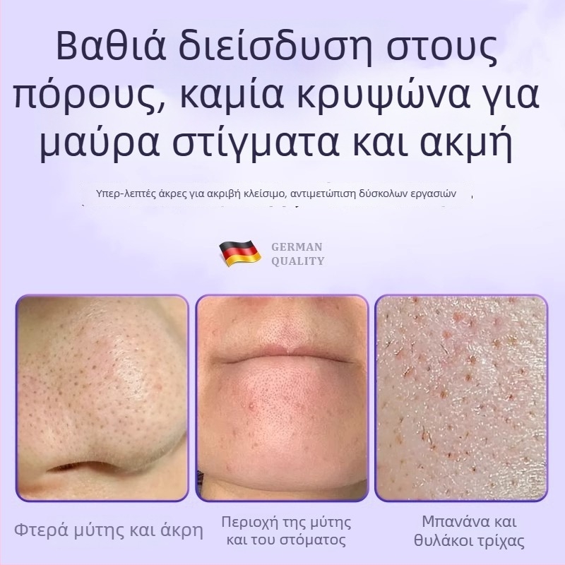 Επαγγελματικό εργαλείο ομορφιάς από ανοξείδωτο ατσάλι: κλιπ κυτταρικού τύπου για ακμή με σχέδιο δελφινιού, προέλευση Yangjiang, Γκουαντόν, διάρκεια ζωής 5 ετών