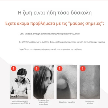 Συσκευή αφαίρεσης μαύρων στιγμάτων, ηλεκτρικός περιστροφικός τρόπος λειτουργίας, μοντέλο SL0001, 3 ρυθμίσεις ταχύτητας, πιστοποιήσεις CE/FCC/ROHS
