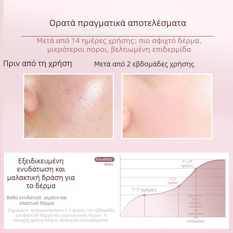 Ατμοποιητής προσώπου με ζεστό ατμό, 5 ρυθμίσεις, ενσωματωμένη μπαταρία 1200-2000mAh, χρόνος ομίχλης άνω των 180 δευτερολέπτων