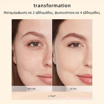 Xin Phil συσκευή μάσκας προσώπου για μείωση ρυτίδων με θεραπεία υπέρυθρης και χρωματικής ακτινοβολίας, φορητή, IPX3 αδιάβροχη.