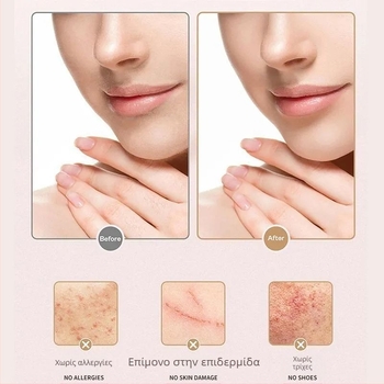 Χειροκίνητη συσκευή αποτρίχωσης Santa Monia, λεπίδα από νανογυάλινο φακό, μονολειτουργική συσκευή αποτρίχωσης