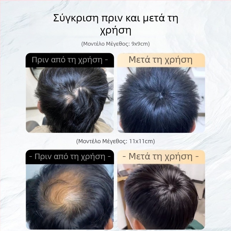 Τμήμα περούκας κορυφής - πραγματικά ανθρώπινα μαλλιά, ίσια τρίχα, αόρατη κάλυψη ουλών και αραιώσεων (δεν βαφεται ή ισιώνεται)