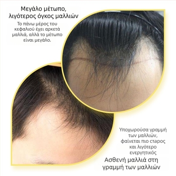 Τμήμα μαλλιών με γραμμή Μ για άνδρες και γυναίκες, χειροποίητο, ανθρώπινα μαλλιά, ίσια τρίχα, για βαφή ή περμανάντ