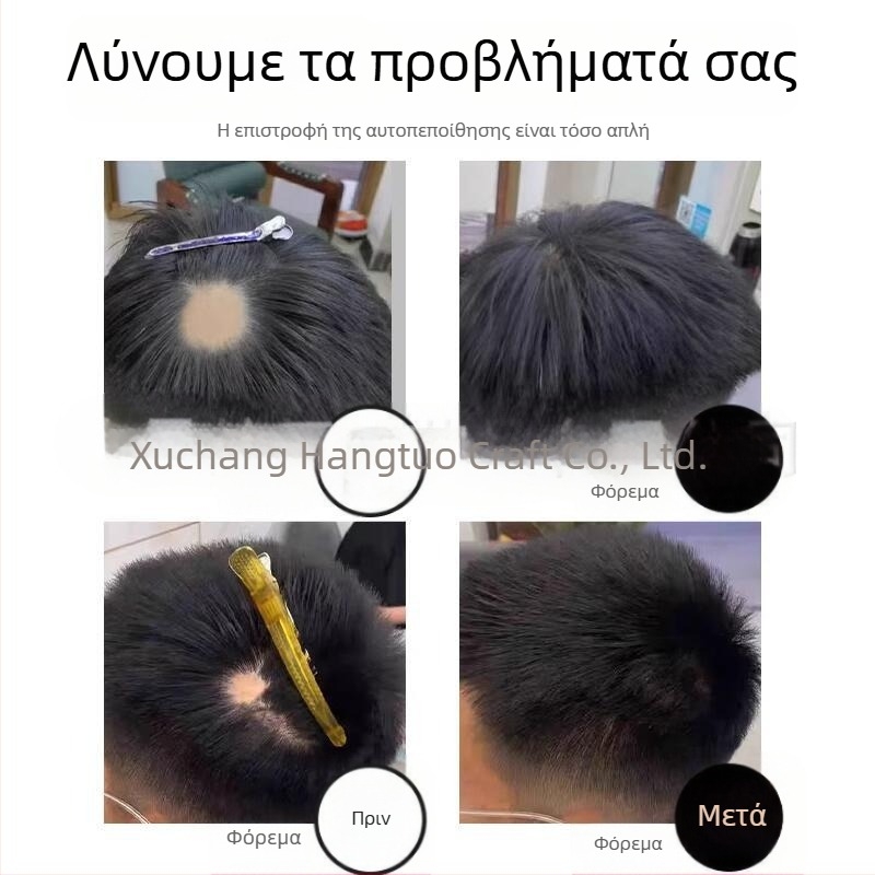 Βιολογικό επίθεμα τριχωτού κεφαλής για ουλές και αλωπεκία – ανθρώπινα μαλλιά, χειροποίητη ύφανση, μπορεί να βαφτεί