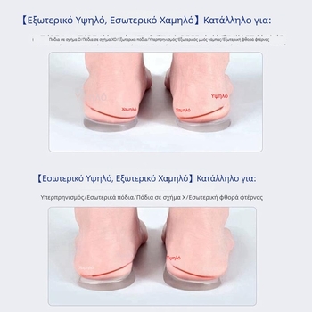 Ορθοπεδική στήριξη καμάρας με γέλη και μαξιλαράκι φτέρνας, Ο- και Χ-τύπου διόρθωση βαλγκούς κάτω άκρου, μαλακή στήριξη καμάρας