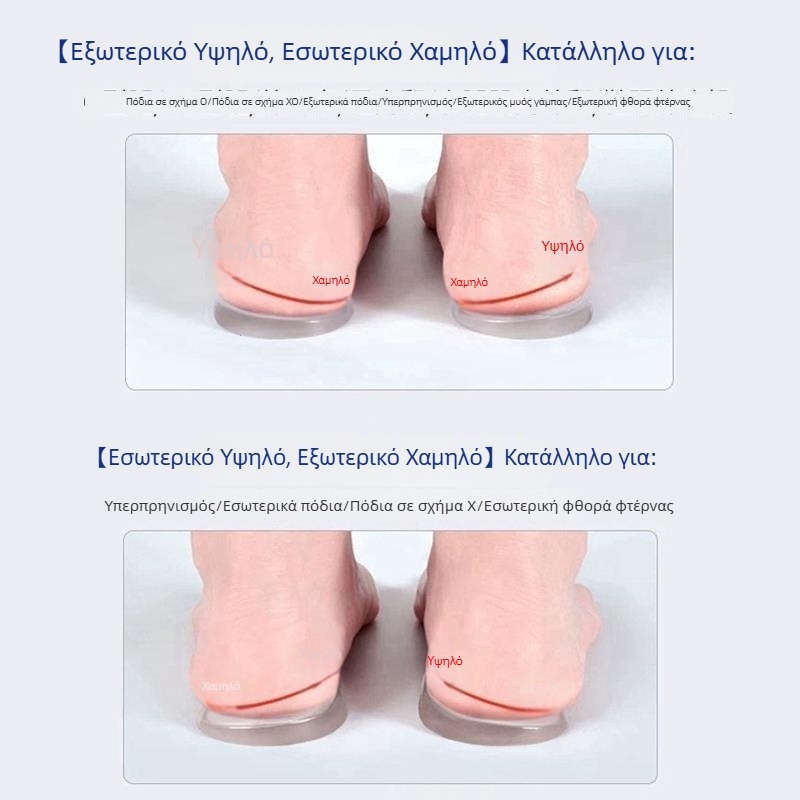 Ορθοπεδική στήριξη καμάρας με γέλη και μαξιλαράκι φτέρνας, Ο- και Χ-τύπου διόρθωση βαλγκούς κάτω άκρου, μαλακή στήριξη καμάρας