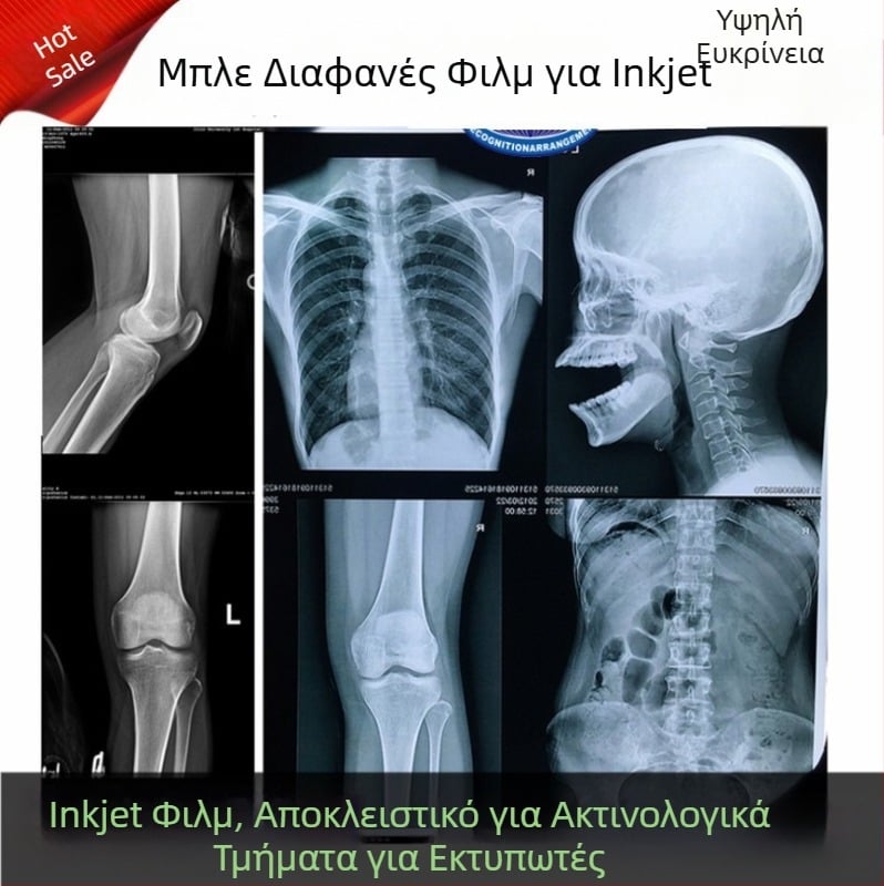 Φιλμ ακτινογραφίας δοντιών με μπλε βάση για ξηρή εκτύπωση ακτινογραφιών DR/CR/CT