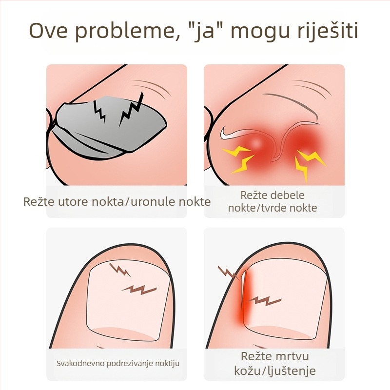 Nove škare za nokte, posebne škare za nokte, kosi produžetak za usta, kliješta za urasli nokat, upala nokta na nozi, pedikura, škare za nokte