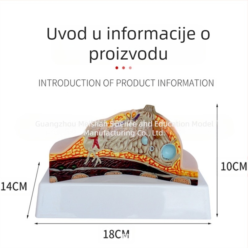 Model patološke dojke za medicinsku edukaciju