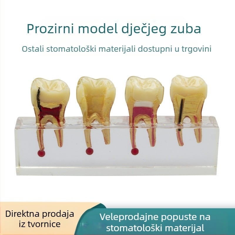 Model za stomatološko obrazovanje dječjih mliječnih zuba s karijesom i popravkom pulpe; GC OEM; 108 g; barkod 236; Uvoz: Ne