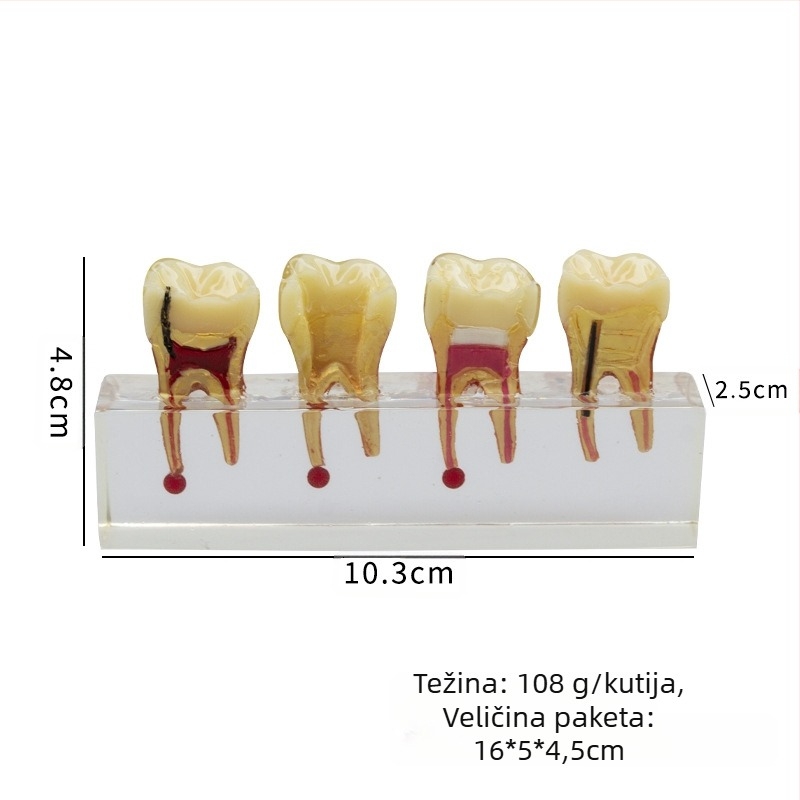 Model za stomatološko obrazovanje dječjih mliječnih zuba s karijesom i popravkom pulpe; GC OEM; 108 g; barkod 236; Uvoz: Ne