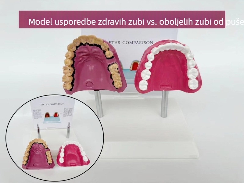 Zubni anatomijski model s strukturnim kalupom za edukaciju oralne njege