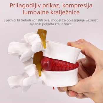 Model lumbalne kralježnice za medicinsku edukaciju – demonstracija kompresije diska i patoloških promjena kostiju kralježnice.