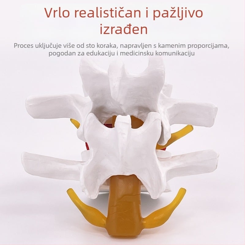 Model lumbalne kralježnice za medicinsku edukaciju – demonstracija kompresije diska i patoloških promjena kostiju kralježnice.