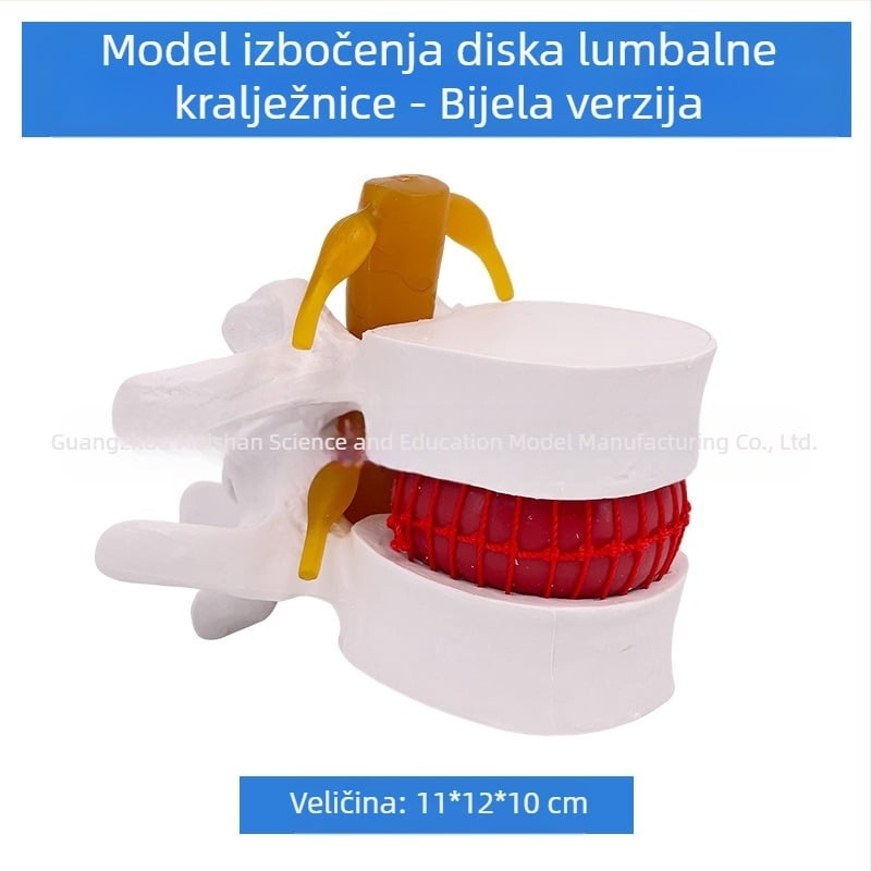 Model lumbalne kralježnice za medicinsku edukaciju – demonstracija kompresije diska i patoloških promjena kostiju kralježnice.