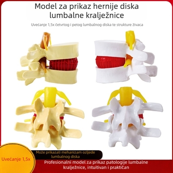 Model intervertebralnog diska, PVC, edukacijski anatomski model za patologiju lumbalne kralježnice, Zhenghe River