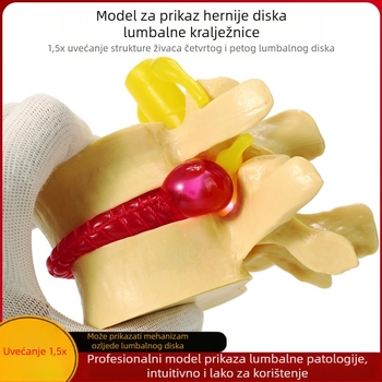 Model intervertebralnog diska, PVC, edukacijski anatomski model za patologiju lumbalne kralježnice, Zhenghe River