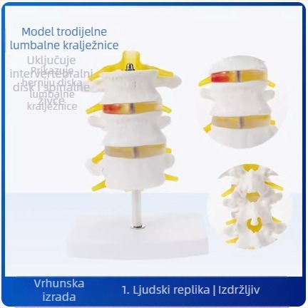 Model intervertebralnog diska, PVC, edukacijski anatomski model za patologiju lumbalne kralježnice, Zhenghe River