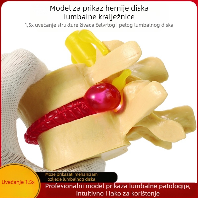 Model intervertebralnog diska, PVC, edukacijski anatomski model za patologiju lumbalne kralježnice, Zhenghe River