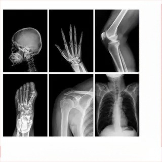 Montessori-Reggio svjetlosno-sjene DIY X-ray prsten edukativna igračka za bebe 0–3 godine, znanstveni kutak za djevojčice