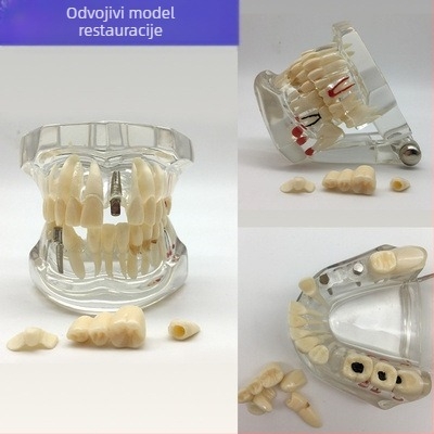 Model za dentalnu nastavu s patološkom rekonstrukcijom zuba i standardnim kalupom za implantate — domaća marka, tiskano logotipom, za dentalno obrazovanje