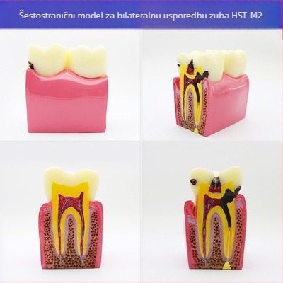Model za dentalnu nastavu s patološkom rekonstrukcijom zuba i standardnim kalupom za implantate — domaća marka, tiskano logotipom, za dentalno obrazovanje
