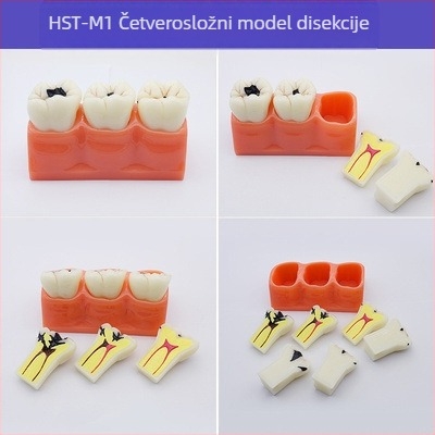 Model za dentalnu nastavu s patološkom rekonstrukcijom zuba i standardnim kalupom za implantate — domaća marka, tiskano logotipom, za dentalno obrazovanje