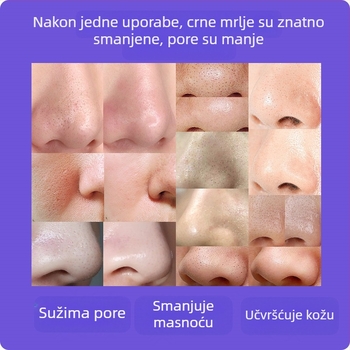 Vizualni uređaj za uklanjanje crnih mrlja — ručni s ultrazvučnim djelovanjem, model ZM613, ABS kućište, 3 razine postavki